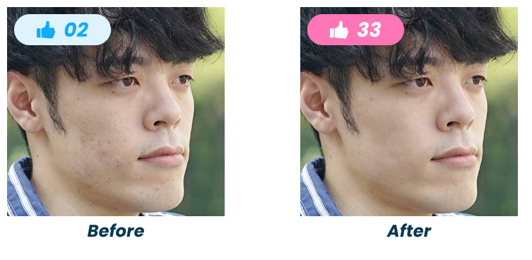 マッチングアプリ写真の肌荒れ補正のBefore/After比較。いいねが2件から33件に増加