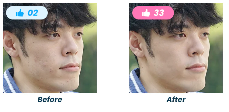 マッチングアプリ写真の肌荒れ補正のBefore/After比較。いいねが2件から33件に増加
