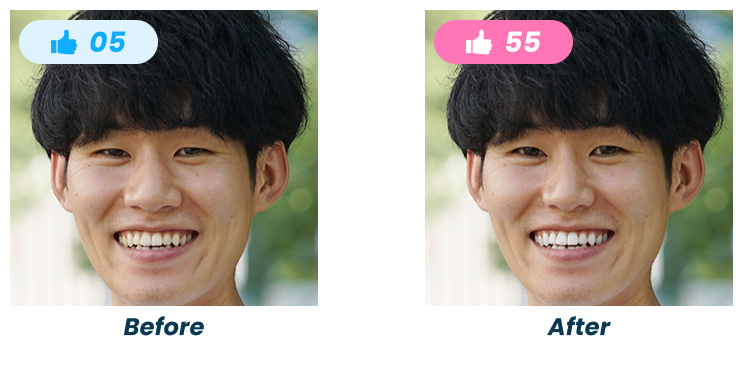 マッチングアプリ写真の歯を白く・目を大きくする補正のBefore/After比較。いいねが5件から66件に増加